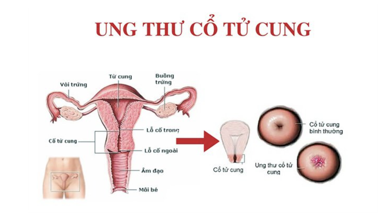 Phòng Khám BS Kha Trâm