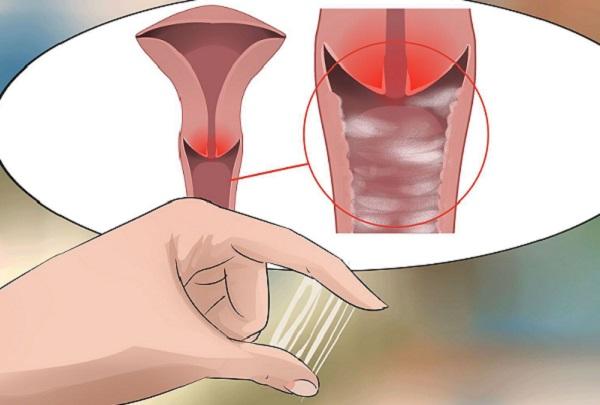 Ra khí hư bất thường, có mùi