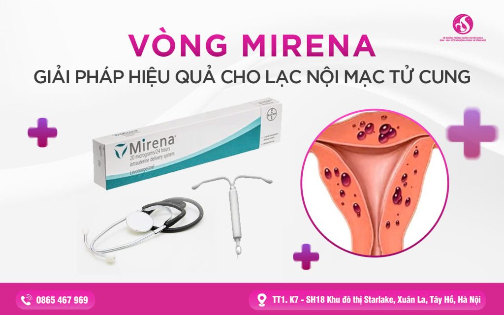VÒNG MIRENA – GIẢI PHÁP HIỆU QUẢ CHO LẠC NỘI MẠC TỬ CUNG