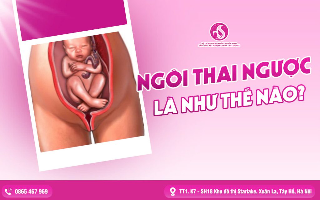 Ngôi Thai Ngược Như Thế Nào?
