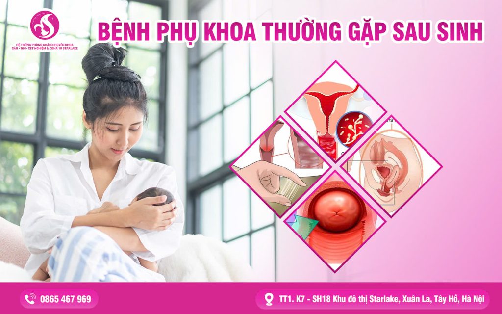 Các Bệnh Phụ Khoa Thường Gặp Sau Sinh