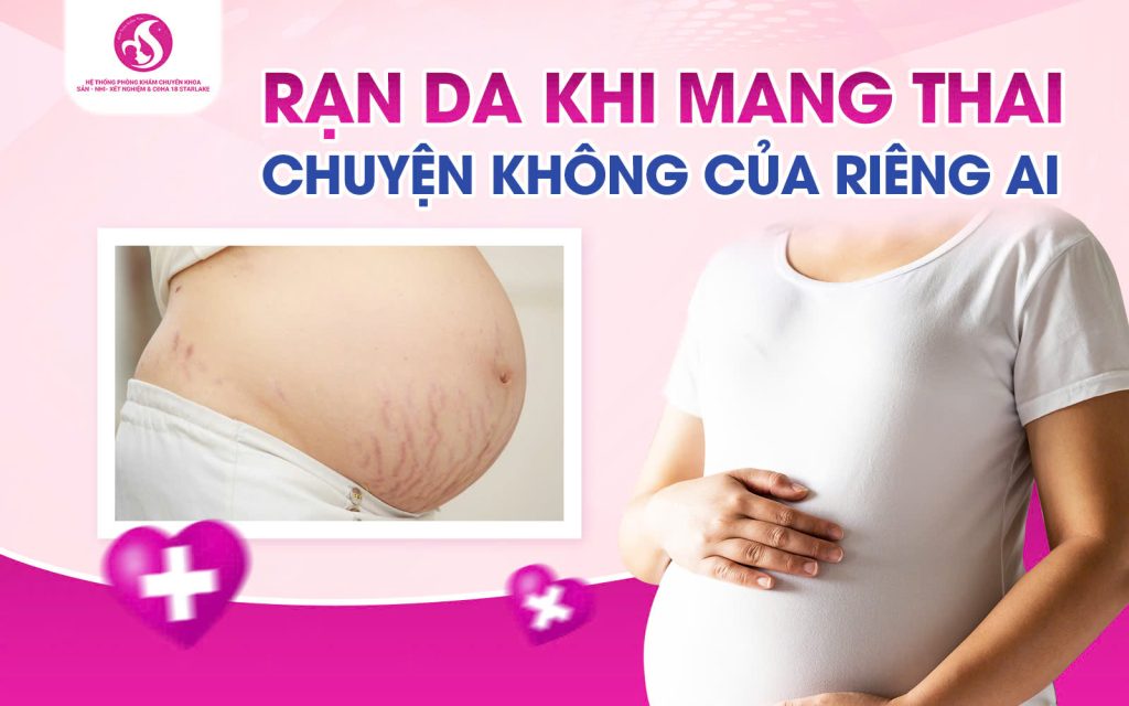 Rạn Da Khi Mang Thai – Chuyện Không Của Riêng Ai